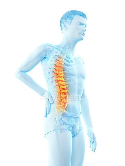 Vista lateral del cuerpo masculino con dolor de espalda sobre fondo blanco, ilustración conceptual
. — Stock Photo