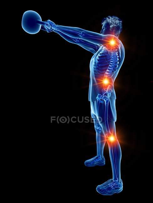 Joints pain during kettlebell workout, conceptual digital illustration. — Stock Photo