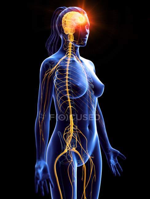 Cancer du cerveau dans le corps féminin, illustration conceptuelle par ordinateur
. — Photo de stock