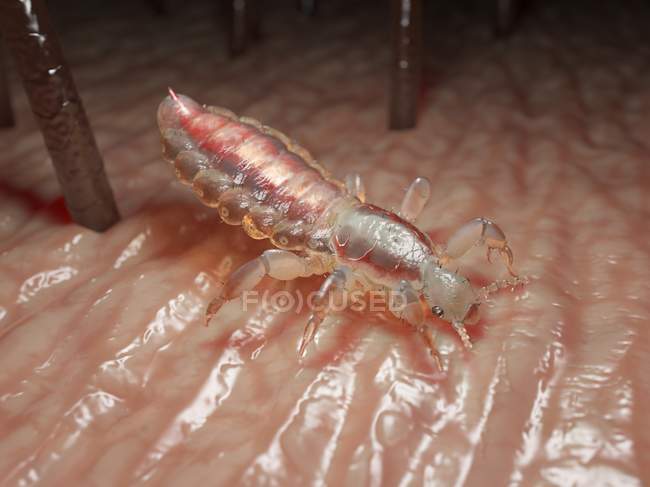 Poux parasites sur la peau de la tête humaine, illustration numérique . — Photo de stock