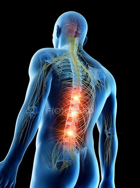 Conceptual digital illustration of back pain in transparent human silhouette. — Stock Photo