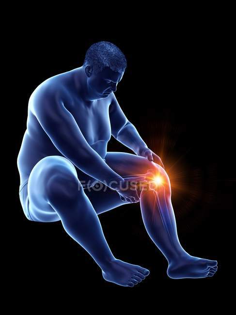 Silueta del hombre obeso sentado que tiene dolor de rodilla, ilustración por computadora . - foto de stock