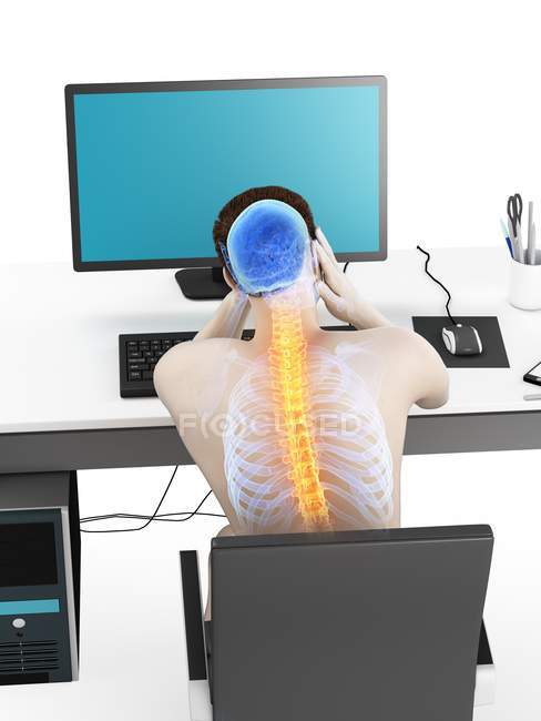 Stressed office worker with back pain in rear view, conceptual illustration. — Stock Photo