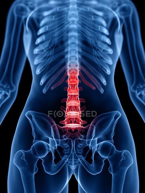 Menschliche Silhouette mit Rückenschmerzen, konzeptionelle Illustration. — Stockfoto