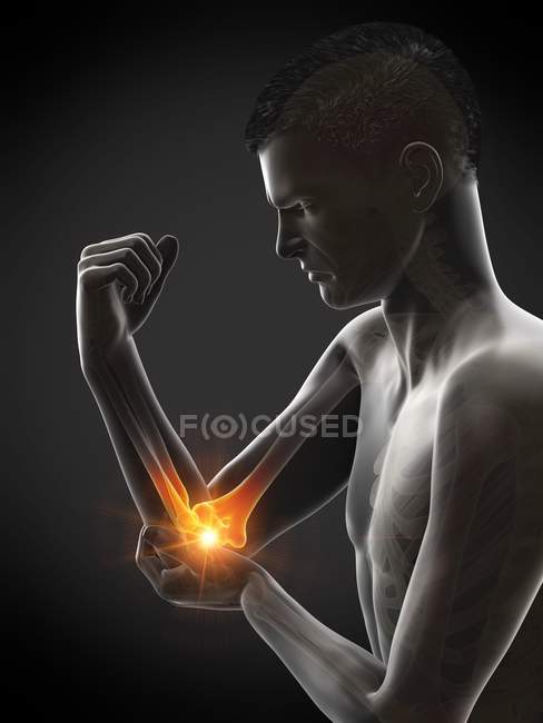 Cuerpo masculino abstracto con dolor de codo visible, ilustración conceptual . - foto de stock