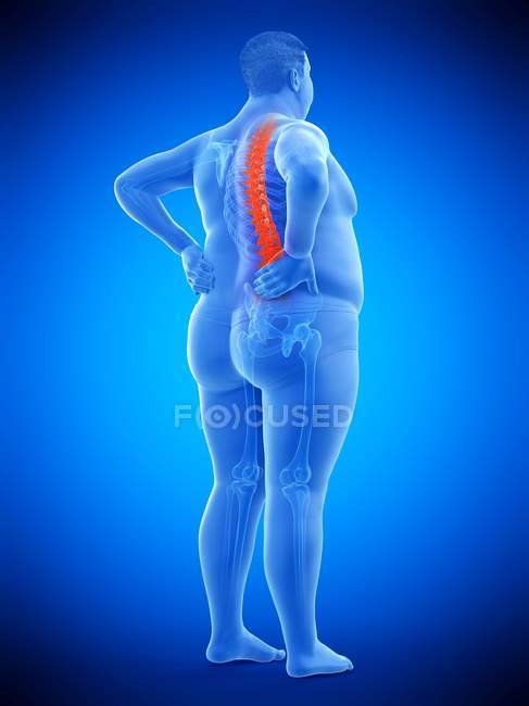 Obeso macho silhueta de comprimento total com dor nas costas, ilustração digital . — Fotografia de Stock