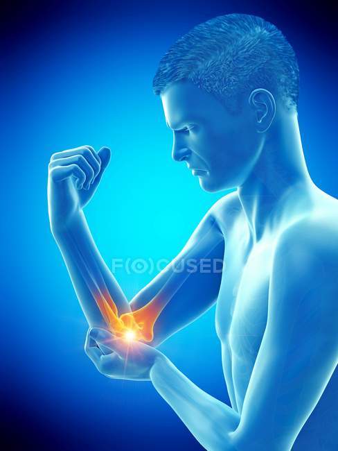 Corpo masculino abstrato com dor visível no cotovelo, ilustração conceitual . — Fotografia de Stock