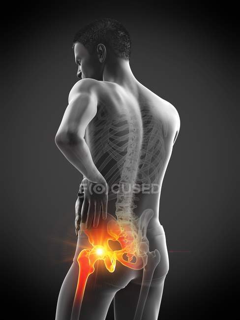 Silhouette masculine abstraite avec douleur visible à la hanche, illustration numérique . — Photo de stock