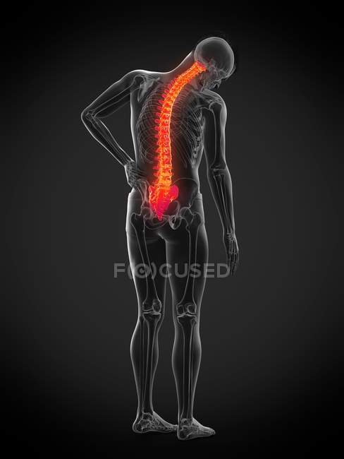 Vista trasera del cuerpo masculino con dolor de espalda, ilustración conceptual . - foto de stock