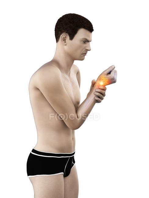 Abstrakter Männerkörper mit Schmerzen am Handgelenk, konzeptionelle Illustration. — Stockfoto