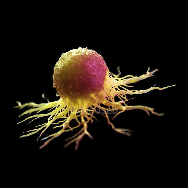 Abstrakte gelb gefärbte Krebszelle auf schwarzem Hintergrund, digitale Illustration. — Stockfoto