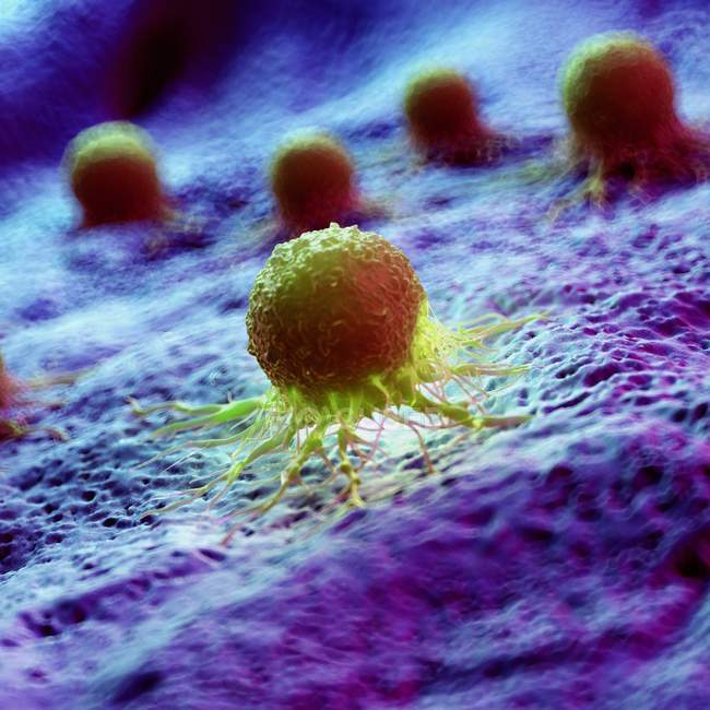 Células cancerosas de color verde abstracto en el tejido, ilustración digital
. - foto de stock