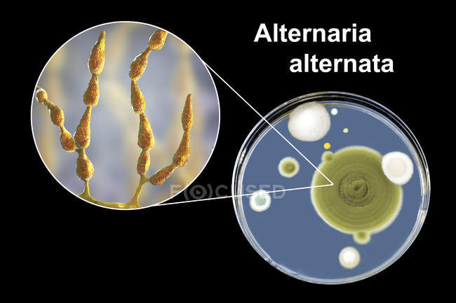 Ilustração digital da morfologia fúngica do fungo alergénico filamentoso Alternaria alternata e fotografia de colónias fúngicas em Sabouraud Dextrose Agar . — Fotografia de Stock