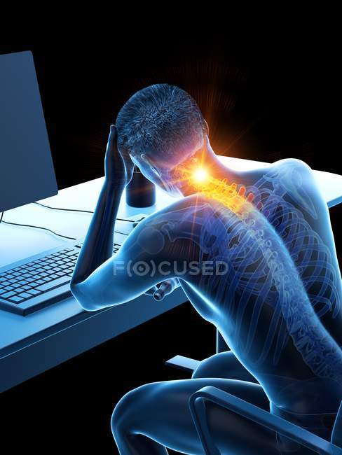 Männliche Büroangestellte am Schreibtisch mit Nackenschmerzen, konzeptionelle digitale Illustration. — Stockfoto