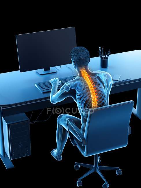 Dolore alla schiena del lavoratore d'ufficio seduto e alla scrivania, illustrazione concettuale . — Foto stock