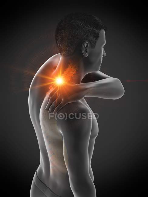 Neck pain, conceptual illustration. — Stock Photo