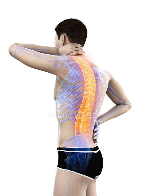 Silueta masculina con dolor de espalda, ilustración conceptual
. - foto de stock