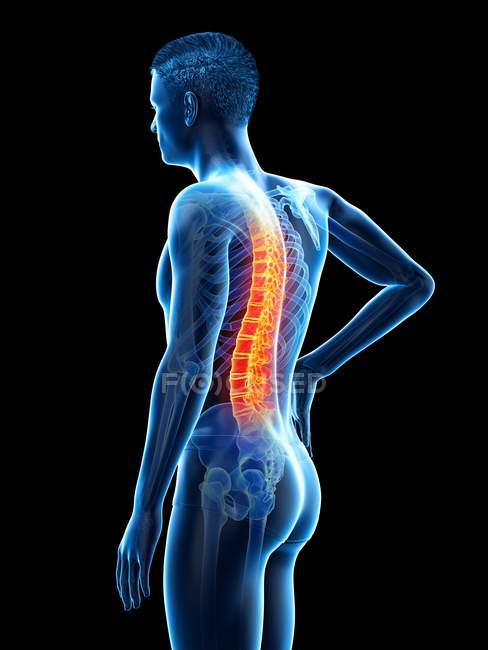 Vista lateral do corpo masculino com dor nas costas em fundo preto, ilustração conceitual . — Fotografia de Stock