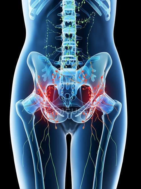 Ganglions lymphatiques abdominaux élargis dans le corps féminin, illustration conceptuelle par ordinateur
. — Photo de stock