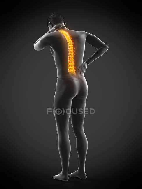 Vista trasera del cuerpo masculino en longitud completa con dolor de espalda, ilustración conceptual . - foto de stock