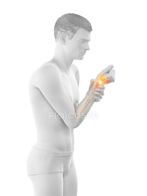 Abstract man body with wrist pain, conceptual illustration. — Stock Photo