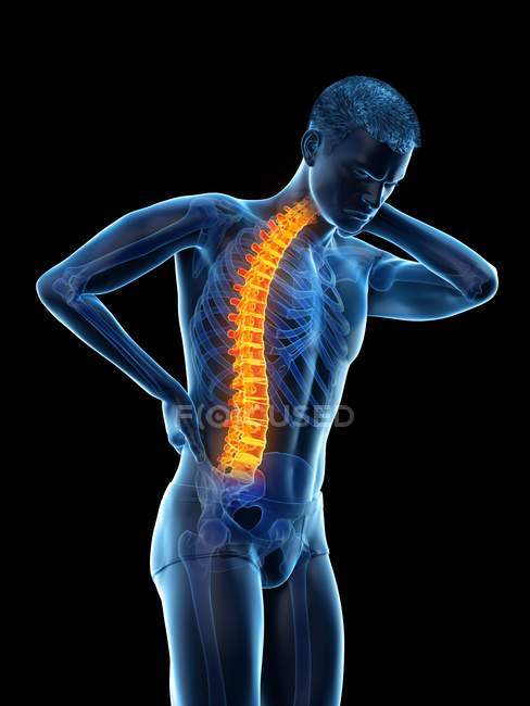 Doblar el cuerpo masculino con dolor de espalda, ilustración conceptual . - foto de stock