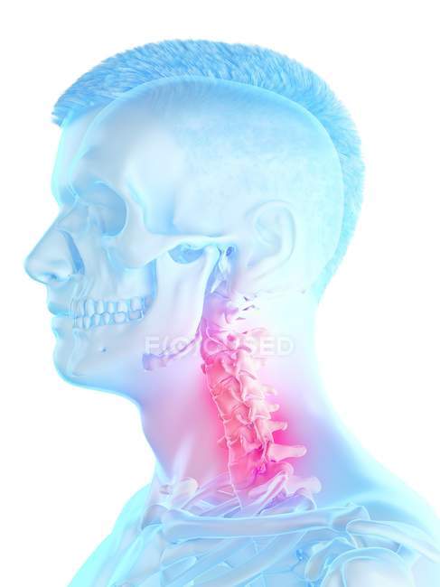 Абстрактне чоловіче тіло з детальним болем в шиї, концептуальна цифрова ілюстрація . — стокове фото