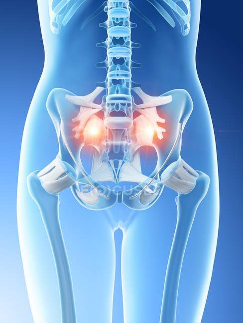 Abstrakte weibliche Hüften, die Schmerzen im unteren Rückenbereich zeigen, konzeptionelle Illustration. — Stockfoto