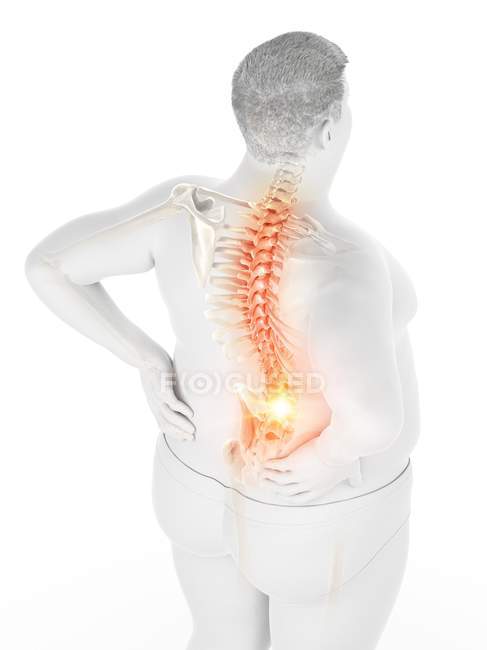 Corpo masculino obeso com dor nas costas em visão de alto ângulo, ilustração digital . — Fotografia de Stock