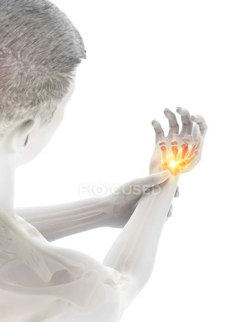 Corps masculin avec douleur au poignet éclatante, illustration conceptuelle . — Photo de stock