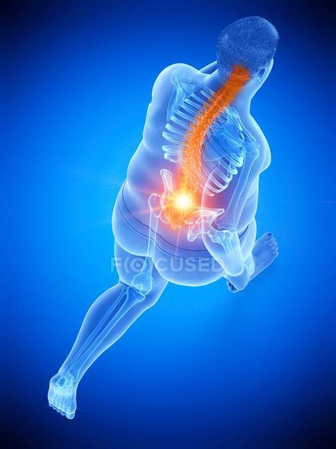 High angle view on overweight runner with back pain, digital illustration. — Stock Photo
