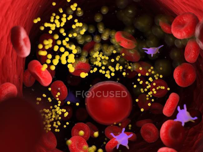 Graisse dans les cellules sanguines bloquant les vaisseaux sanguins, illustration numérique . — Photo de stock