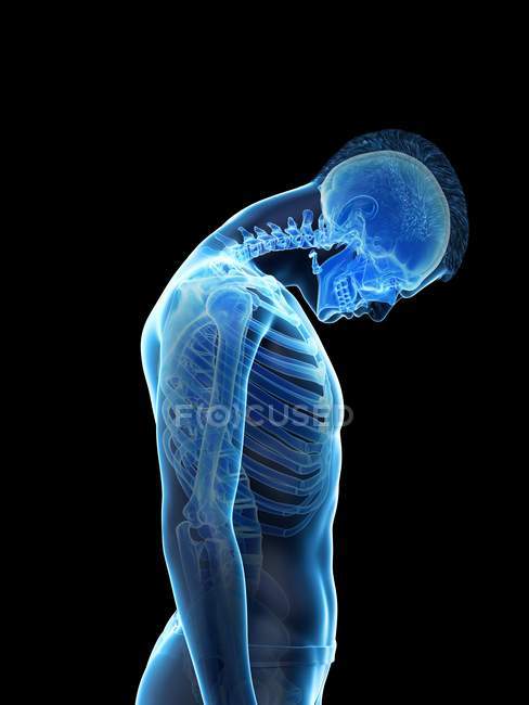 Male silhouette showing anatomy of neck injury, digital illustration. — Stock Photo