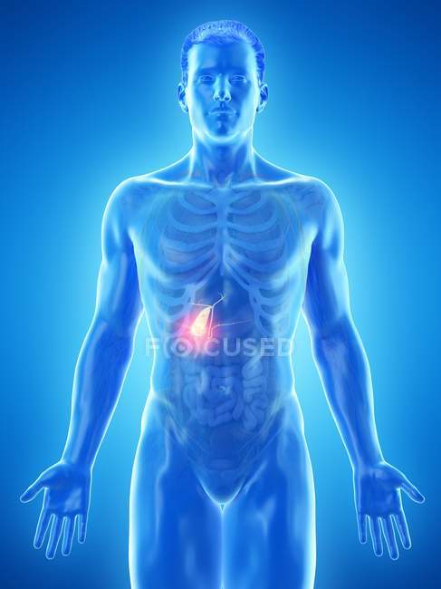 Cancro alla cistifellea nel modello 3d del corpo maschile, illustrazione del computer . — Foto stock