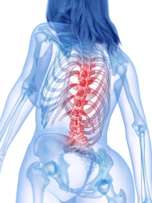 Silhueta do corpo feminino com dor nas costas em visão de baixo ângulo, ilustração conceitual . — Fotografia de Stock