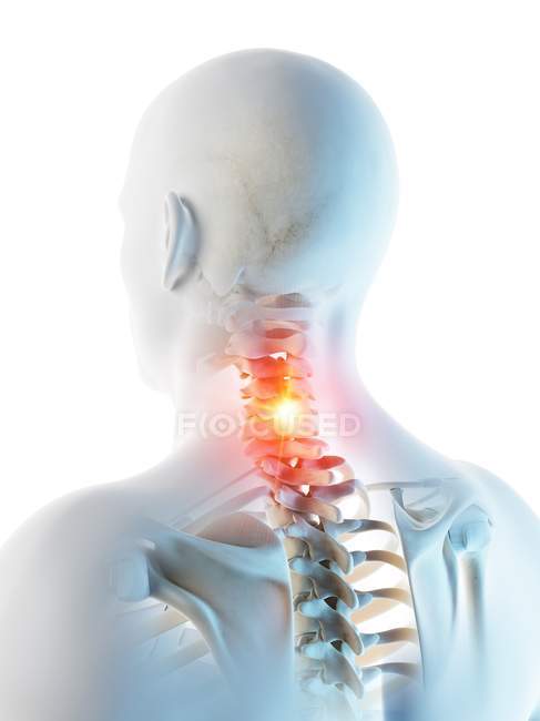 Corpo masculino abstrato com dor cervical detalhada, ilustração digital conceitual
. — Fotografia de Stock