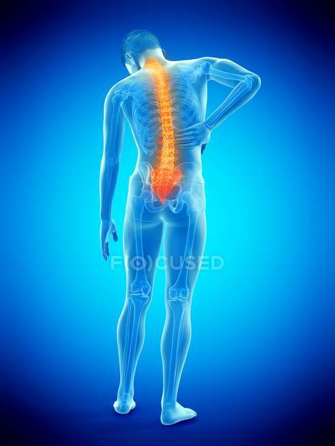 Visão traseira do corpo masculino com inflamação e dor nas costas, ilustração conceitual . — Fotografia de Stock