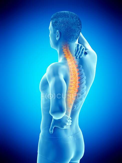 Silueta masculina con dolor de espalda, ilustración conceptual . - foto de stock