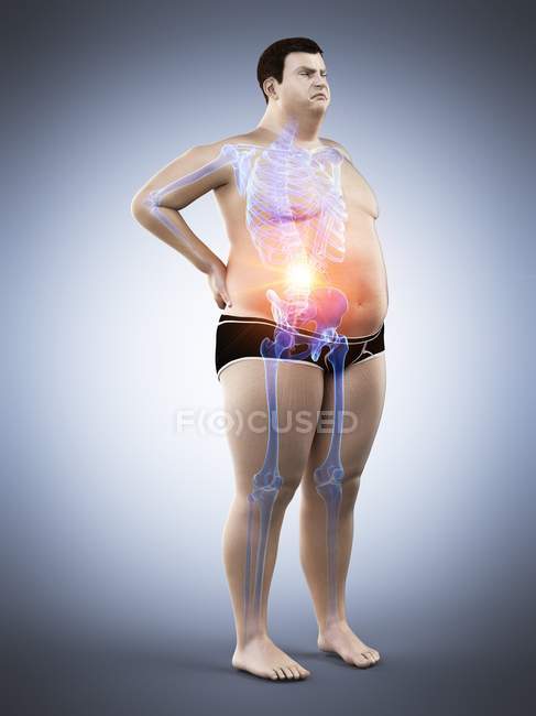 Fettleibige männliche Silhouette in voller Länge mit Rückenschmerzen, digitale Illustration. — Stockfoto