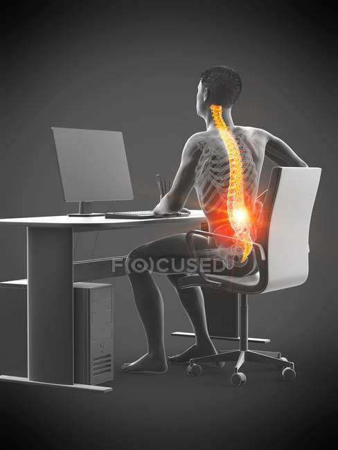 Ufficio silhouette lavoratore seduto alla scrivania con mal di schiena, illustrazione concettuale . — Foto stock