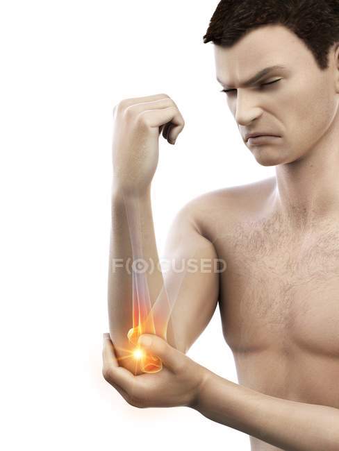 Cuerpo masculino abstracto con dolor de codo visible, ilustración conceptual
. - foto de stock