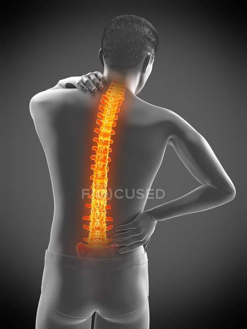 Männliche Silhouette mit Rückenschmerzen, konzeptionelle Illustration. — Stockfoto