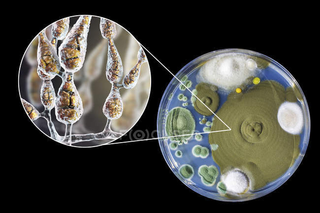 Illustrazione digitale della morfologia fungina del fungo allergenico filamentoso Alternaria alternata e fotografia di colonie fungine su Sabouraud Destrosio Agar
. — Foto stock