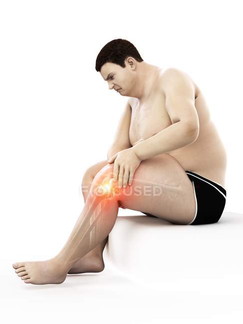 Silueta del hombre obeso sentado que tiene dolor de rodilla, ilustración por computadora
. - foto de stock