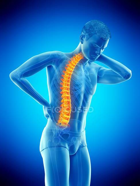 Doblar el cuerpo masculino con dolor de espalda, ilustración conceptual . - foto de stock