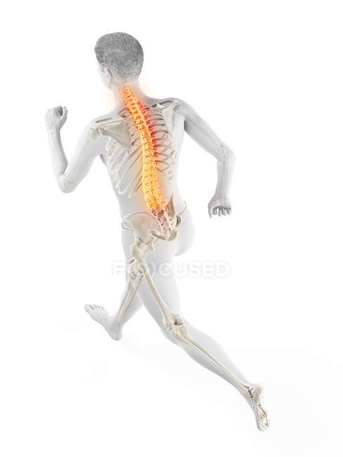 Silueta de atleta en carrera con dolor de espalda, ilustración conceptual . - foto de stock
