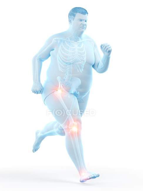 Silhouette eines fettleibigen Mannes mit Gelenkschmerzen, Computerillustration. — Stockfoto