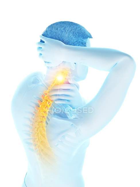 Male body with visible neck pain, conceptual illustration. — Stock Photo