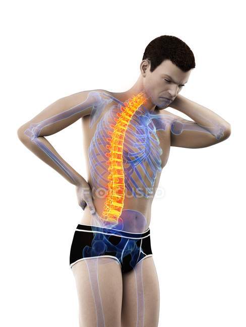 Doblar el cuerpo masculino con dolor de espalda, ilustración conceptual
. - foto de stock