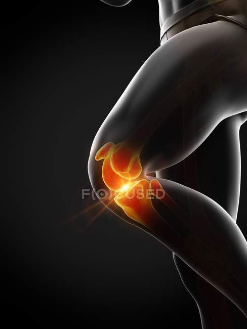 Corps humain avec douleur au genou, illustration numérique conceptuelle . — Photo de stock